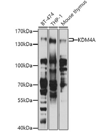 KDM4A Rabbit Polyclonal Antibody