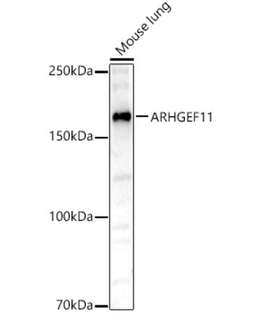ARHGEF11 Rabbit Polyclonal Antibody