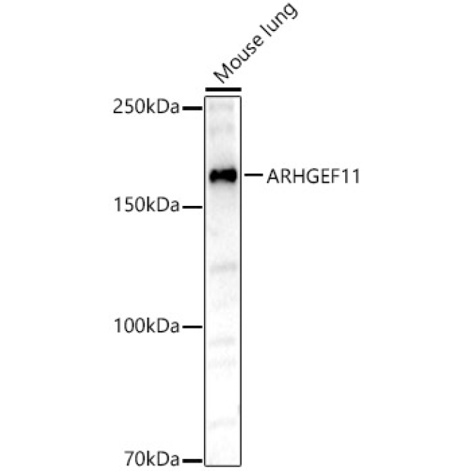 ARHGEF11 Rabbit Polyclonal Antibody