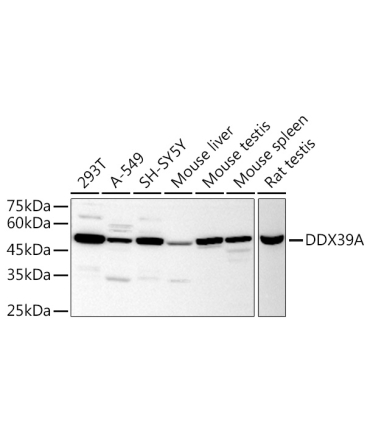 DDX39A Rabbit Polyclonal Antibody