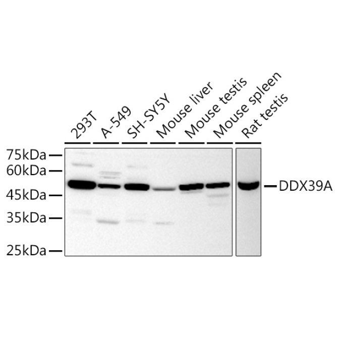 DDX39A Rabbit Polyclonal Antibody