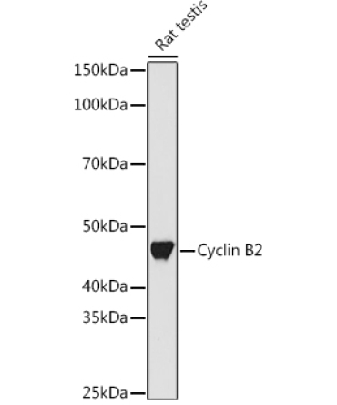 Cyclin B2 Rabbit Monoclonal Antibody