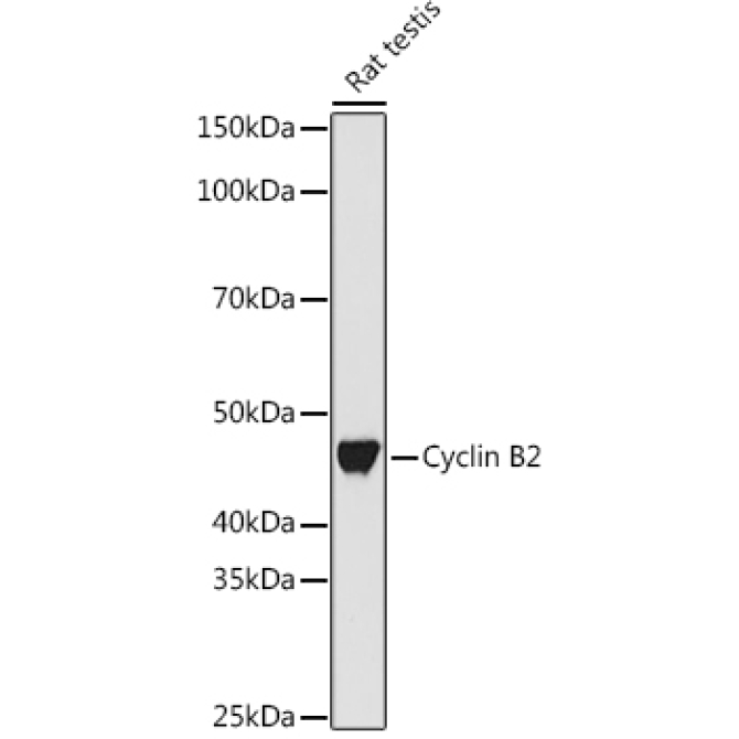 Cyclin B2 Rabbit Monoclonal Antibody