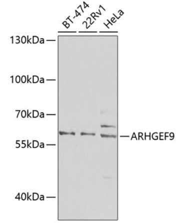 ARHGEF9 Rabbit Polyclonal Antibody