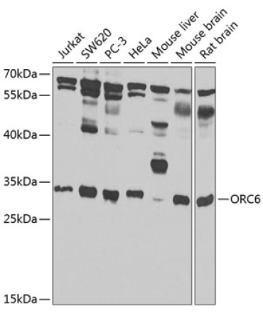 ORC6 Rabbit Polyclonal Antibody