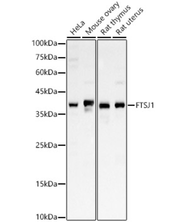 FTSJ1 Rabbit Polyclonal Antibody