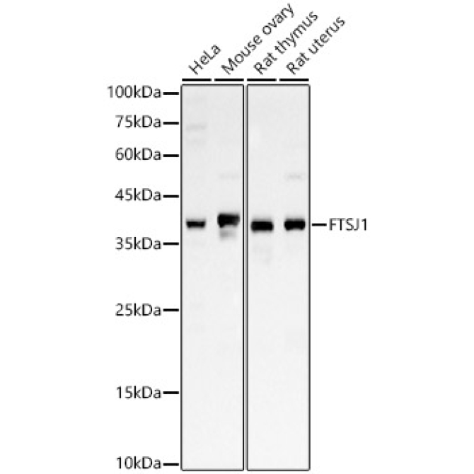 FTSJ1 Rabbit Polyclonal Antibody