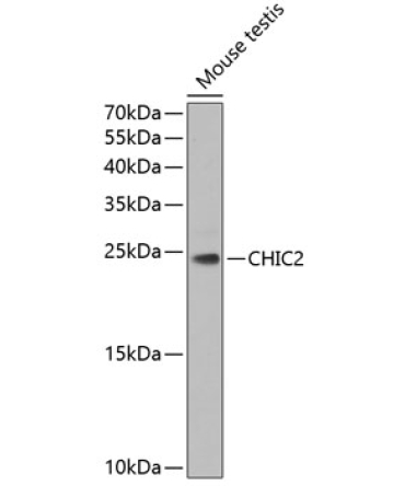 CHIC2 Rabbit Polyclonal Antibody