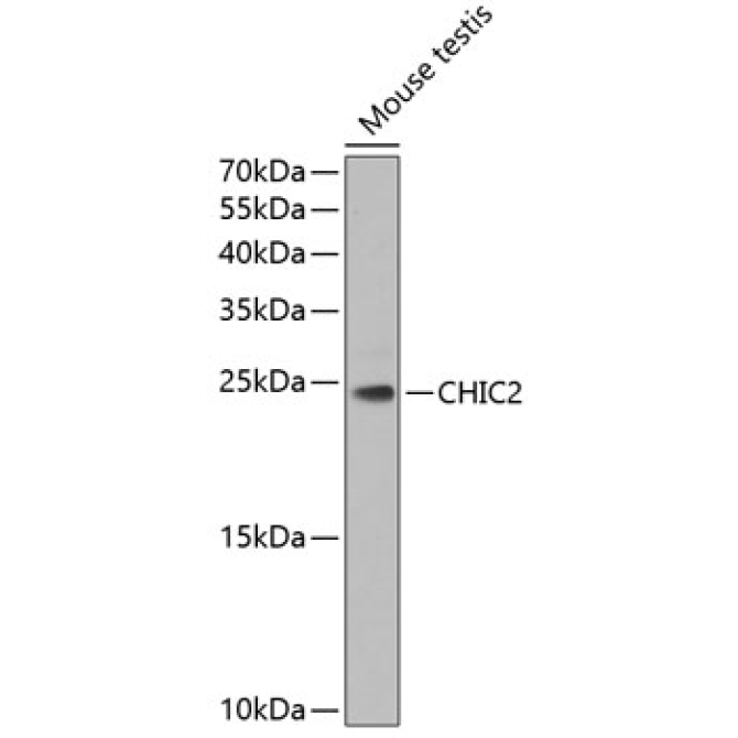 CHIC2 Rabbit Polyclonal Antibody