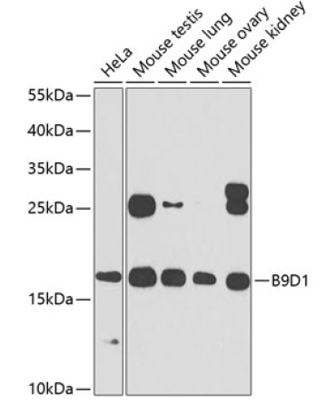 B9D1 Rabbit Polyclonal Antibody