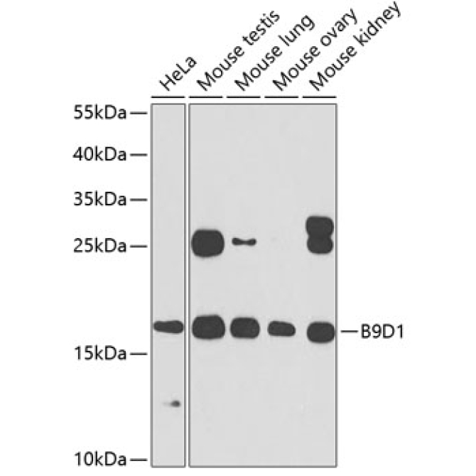 B9D1 Rabbit Polyclonal Antibody