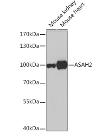 ASAH2 Rabbit Polyclonal Antibody