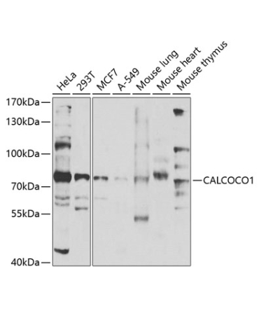 CALCOCO1 Rabbit Polyclonal Antibody