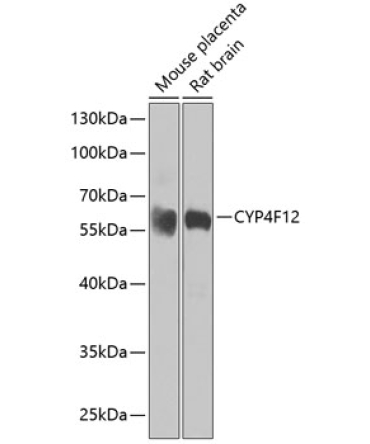 CYP4F12 Rabbit Polyclonal Antibody