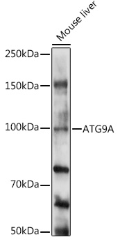 ATG9A Rabbit Polyclonal Antibody