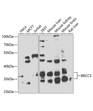 BRCC3 Rabbit Polyclonal Antibody