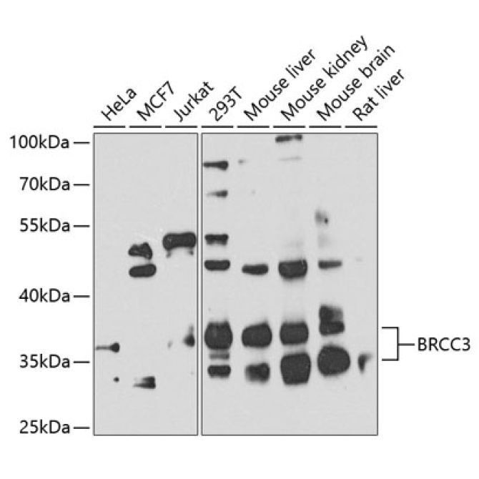 BRCC3 Rabbit Polyclonal Antibody