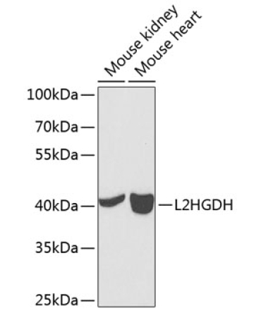 L2HGDH Rabbit Polyclonal Antibody