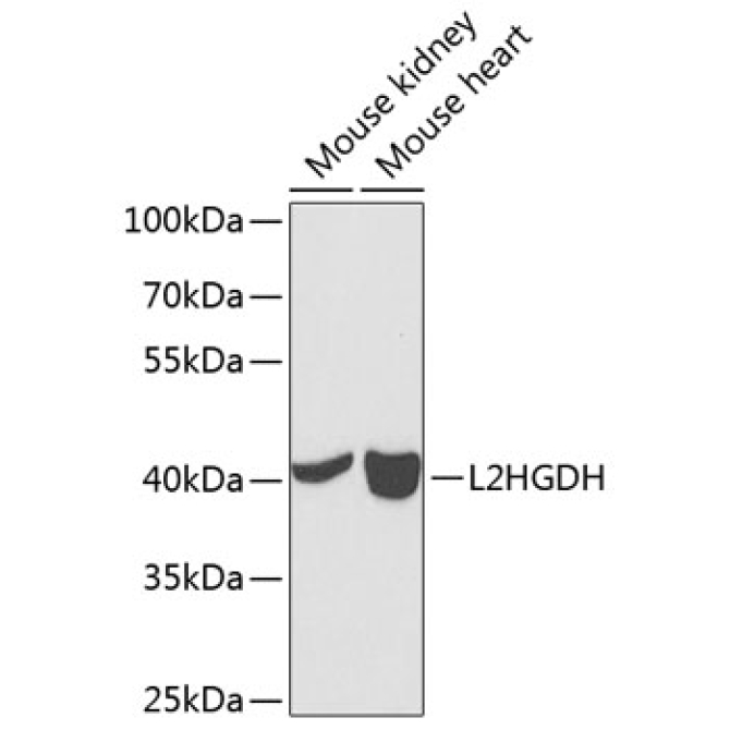 L2HGDH Rabbit Polyclonal Antibody