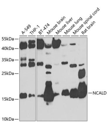 NCALD Rabbit Polyclonal Antibody