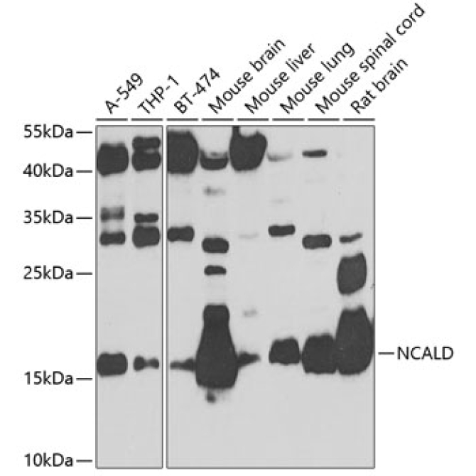 NCALD Rabbit Polyclonal Antibody