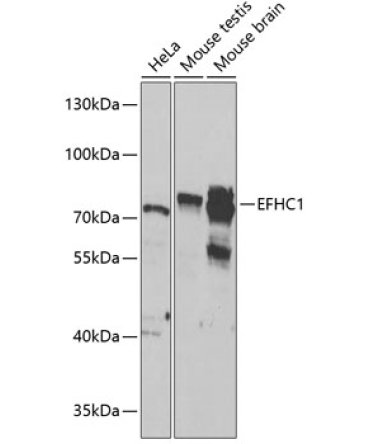 EFHC1 Rabbit Polyclonal Antibody