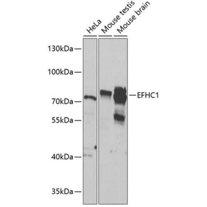 EFHC1 Rabbit Polyclonal Antibody