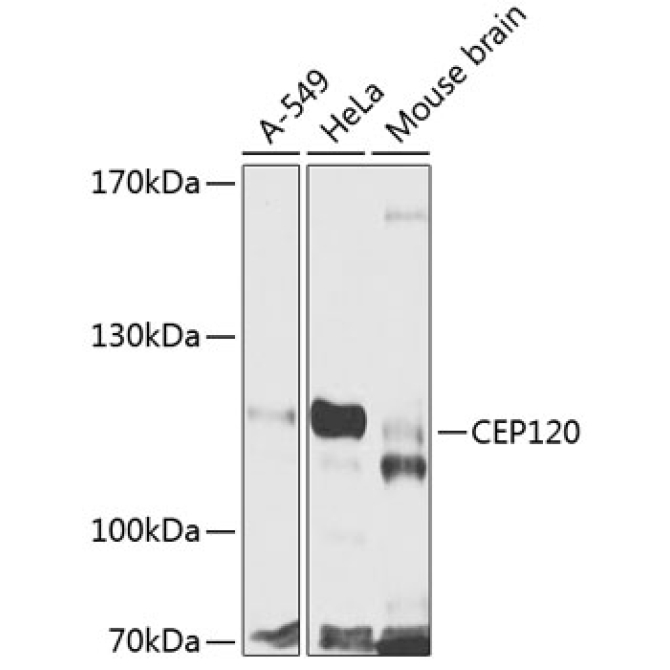 CEP120 Rabbit Polyclonal Antibody