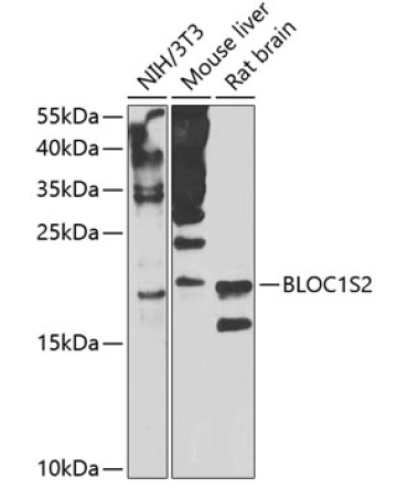 BLOC1S2 Rabbit Polyclonal Antibody