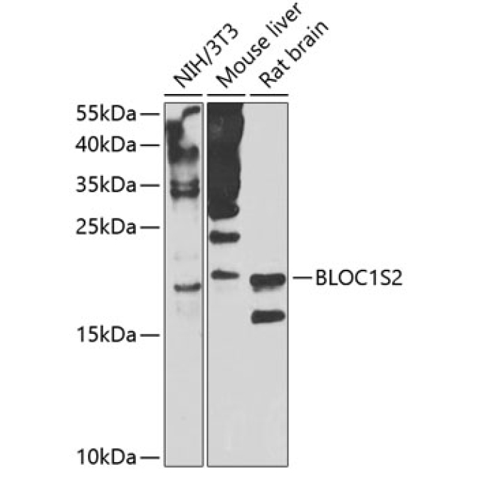 BLOC1S2 Rabbit Polyclonal Antibody