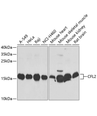 CFL2 Rabbit Polyclonal Antibody