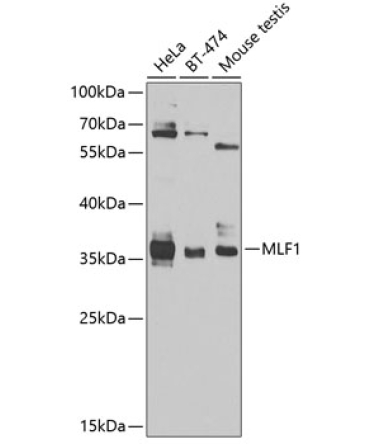 MLF1 Rabbit Polyclonal Antibody