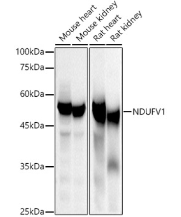 NDUFV1 Rabbit Polyclonal Antibody