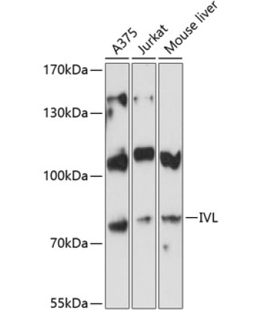 IVL Rabbit Polyclonal Antibody