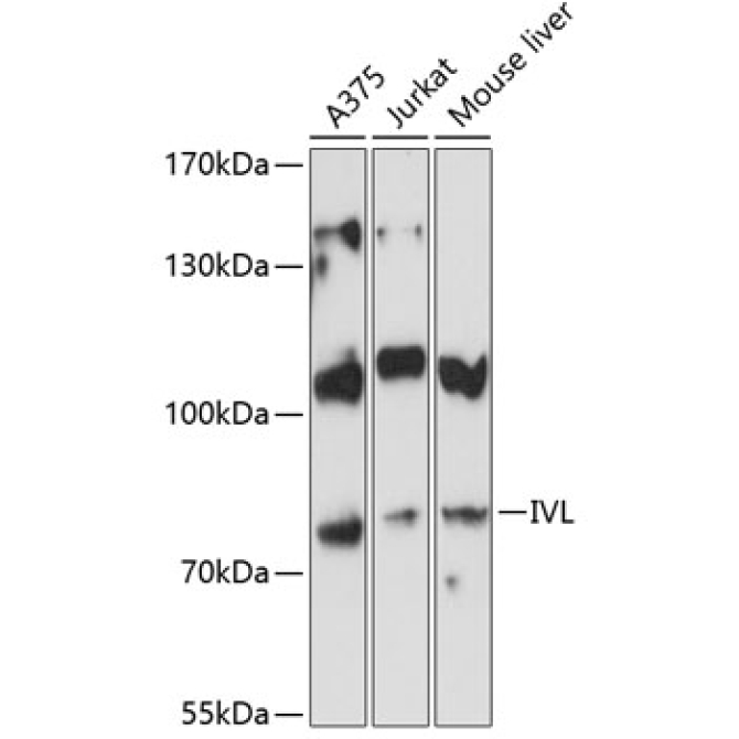 IVL Rabbit Polyclonal Antibody