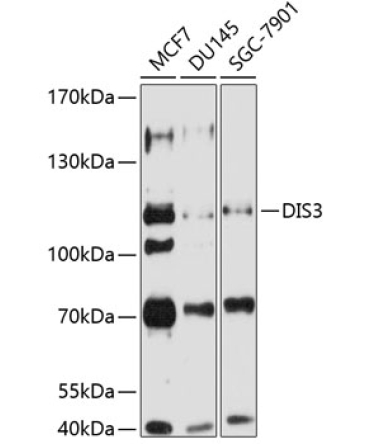 DIS3 Rabbit Polyclonal Antibody