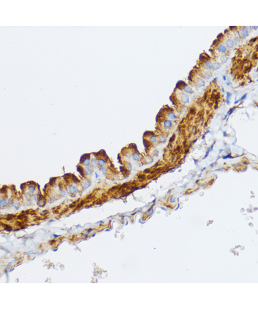 MYLK Rabbit Polyclonal Antibody