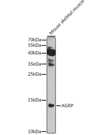 AGRP Rabbit Polyclonal Antibody