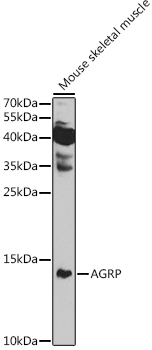 AGRP Rabbit Polyclonal Antibody
