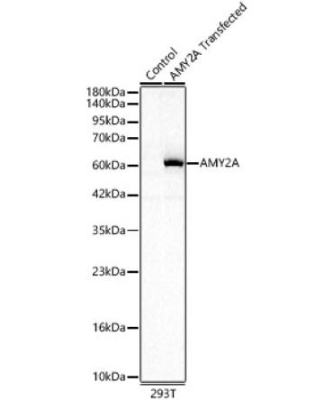 AMY2A Rabbit Polyclonal Antibody