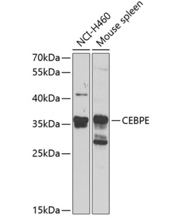 CEBPE Rabbit Polyclonal Antibody