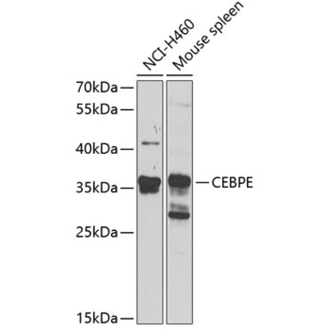 CEBPE Rabbit Polyclonal Antibody
