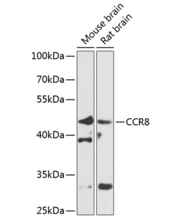 CCR8 Rabbit Polyclonal Antibody