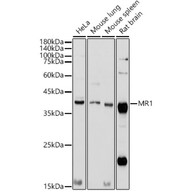 MR1 Rabbit Polyclonal Antibody