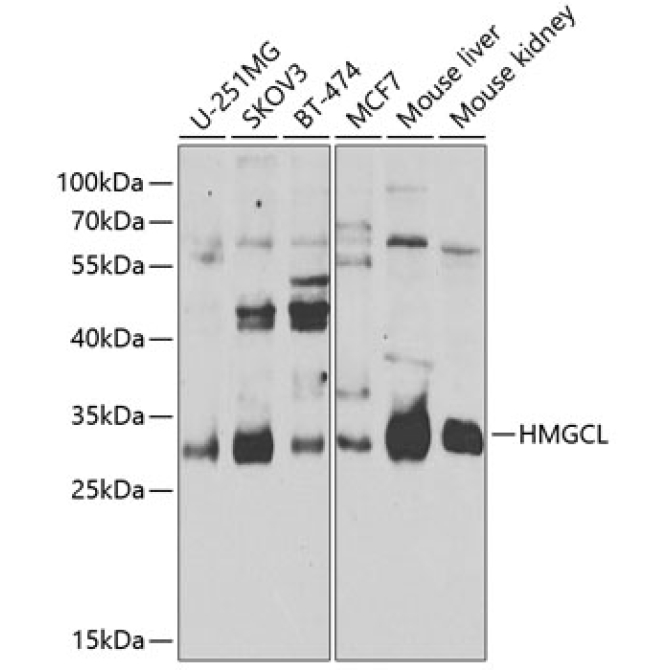 HMGCL Rabbit Polyclonal Antibody