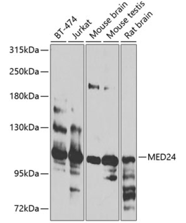 MED24 Rabbit Polyclonal Antibody