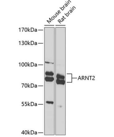 ARNT2 Rabbit Polyclonal Antibody