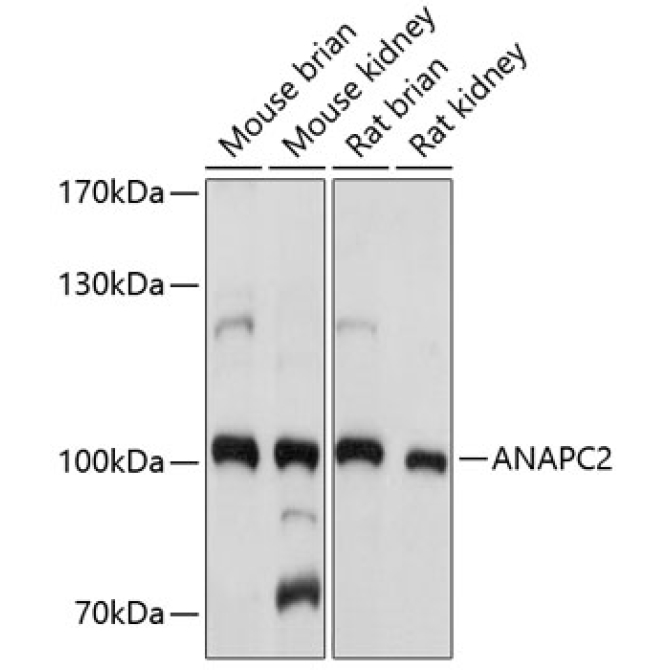 ANAPC2 Rabbit Polyclonal Antibody