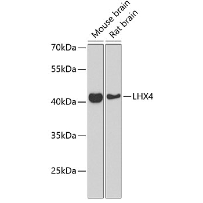 LHX4 Rabbit Polyclonal Antibody