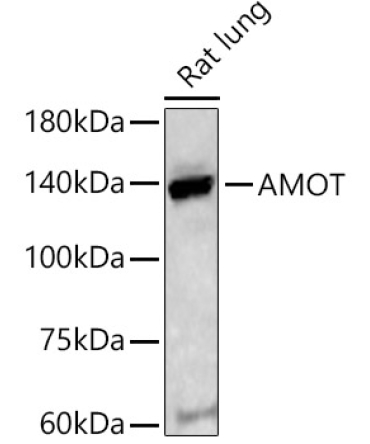 AMOT Rabbit Polyclonal Antibody